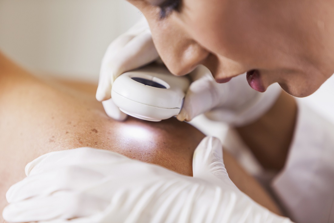 Skin Examination